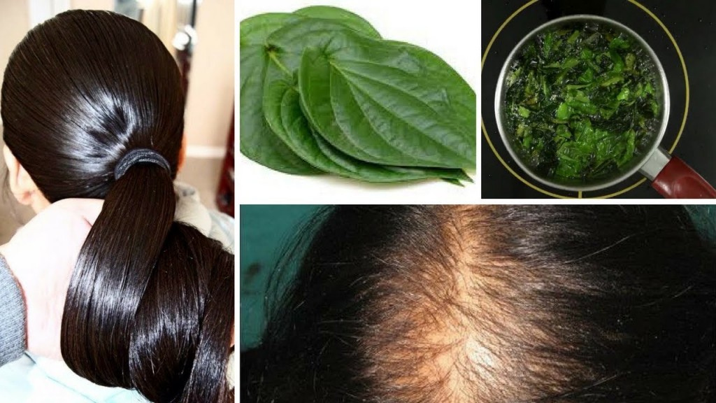 Treatment of hair loss